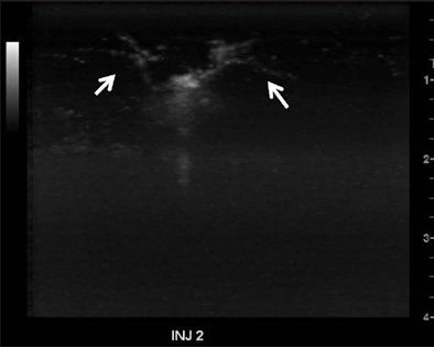 2010 08 04 12 49 48 800 Dave Figure 1 E 394