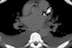 2010 08 11 13 10 42 472 Williams missedcalc Thumb