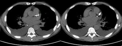 2010 08 11 13 10 43 343 Williams missedcalc 450