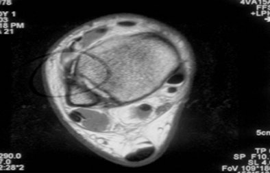 2010 08 11 16 37 59 119 Vikings Clinical Image 394