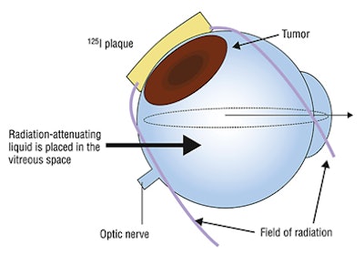 2010 08 12 11 24 51 120 2010 08 16 Eye
