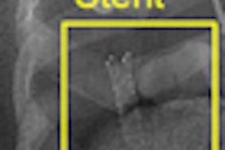 2010 08 13 10 07 10 431 Siewerdsen Clinical Thumb