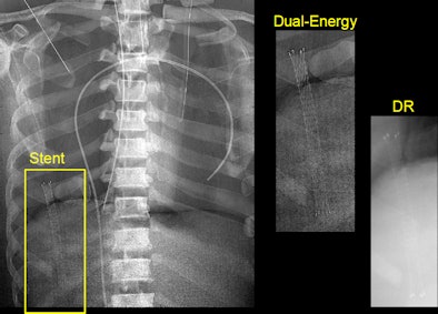 2010 08 13 10 07 11 870 Siewerdsen Clinical Sl13 394