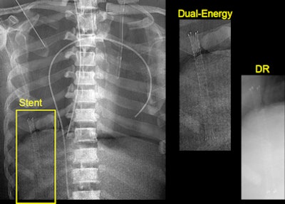 2010 08 13 10 07 11 870 Siewerdsen Clinical Sl13 394