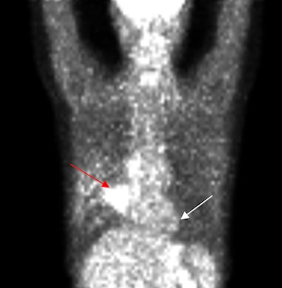 2010 08 13 17 11 25 173 Rollo Slide22 Fdg Pet 394