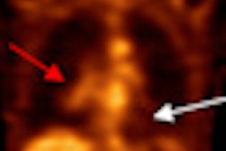 2010 08 13 17 11 26 403 Rollo Slide22 Ecdg Thumb