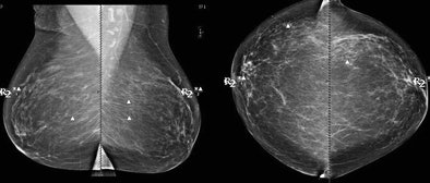 2010 08 19 12 35 45 611 Destounis ca Dmarked2