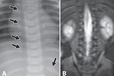 2010 08 23 13 03 32 609 Mri Pediatric Image 450