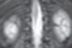 2010 08 23 13 03 32 72 Mri Pediatric Image 70