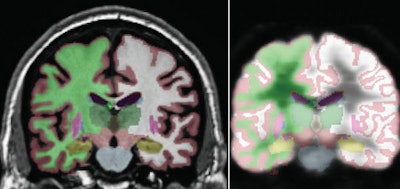 2010 08 26 13 53 34 366 Ad Pet Mri Karow Combined 450