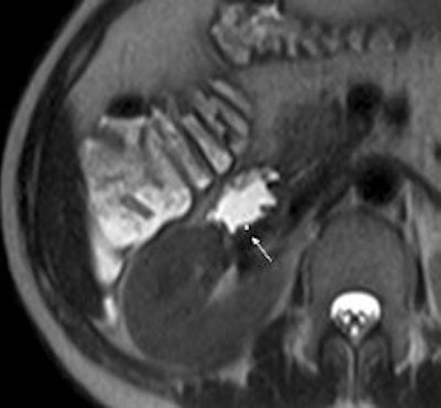 2010 08 31 13 38 56 31 Celiac Healthy C 250