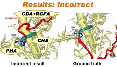2010 09 01 13 30 31 118 Kitasaka incorrect bottom