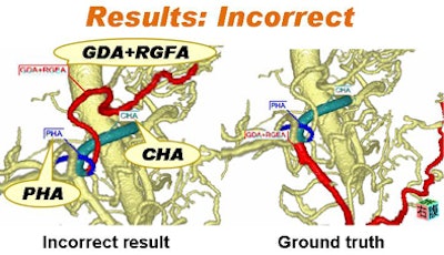 2010 09 01 13 30 31 118 Kitasaka incorrect bottom