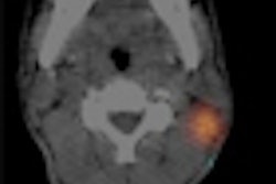 2010 09 02 14 51 14 593 Planar Spect Images Thumb