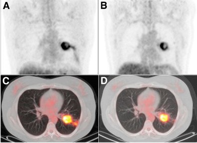 2010 09 16 11 29 20 943 Erlotinib Image 395