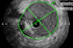 2010 09 20 13 10 39 48 Dey athero Thumb 70x70