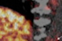 2010 09 27 09 17 20 380 Asnc Pet Ct Plaque 01 Thumb
