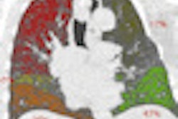 2010 09 27 11 01 07 867 Vanginneken thumb 70x70