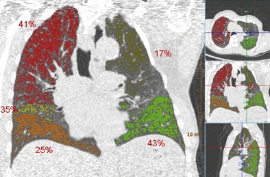 2010 09 27 11 01 13 774 Vanginneken example2 bottom