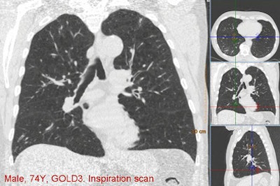 2010 09 27 11 01 15 235 Vanginneken example1 top