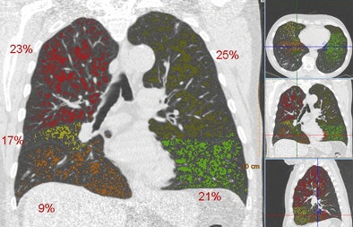 2010 09 27 11 01 17 671 Vanginneken example1 bottom