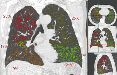 2010 09 27 11 01 17 671 Vanginneken example1 bottom