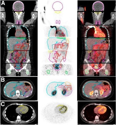 2010 10 01 14 40 24 195 Rubidium Bengel 379