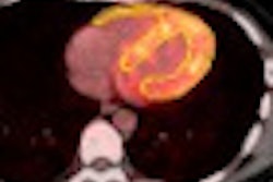 2010 10 01 14 40 24 993 Rubidium Bengel 01 Thumb