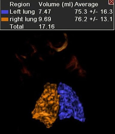2010 10 06 15 36 31 478 Lee 3dlungbottom V2