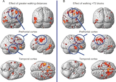 2010 10 13 13 59 28 952 2010 10 14 Erickson Mri Scans