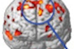 2010 10 13 13 59 33 451 2010 10 14 Erickson Mri Scans Thumb