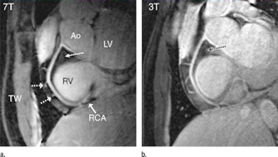 2010 10 19 11 03 27 977 18 Yr Old Mr Images 394