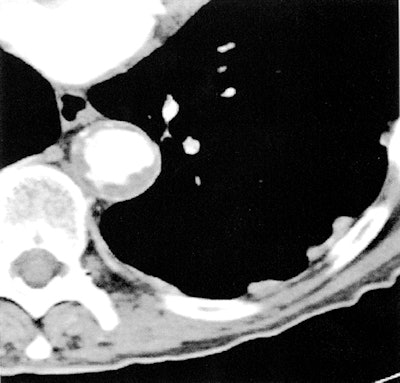 2010 10 20 16 21 44 524 210 10 22 Gondrie 2a