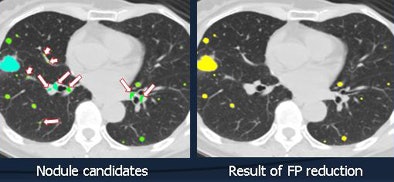 2010 10 28 10 33 19 925 Chen fp reduction New
