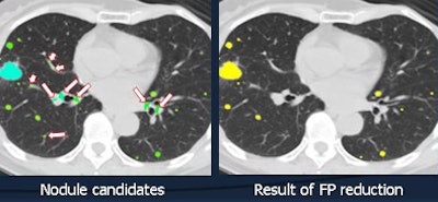 2010 10 28 10 33 19 925 Chen fp reduction New