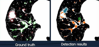 2010 10 28 10 33 31 34 Chen bifurcation detection New