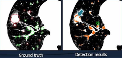 2010 10 28 10 33 31 34 Chen bifurcation detection New