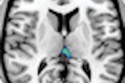 2010 11 01 13 39 03 880 Mri Ms Images Thumb