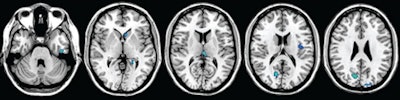 2010 11 01 13 39 04 510 Mri Ms Images 450