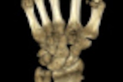 2010 11 10 14 36 22 397 Verity Bone Image Thumb