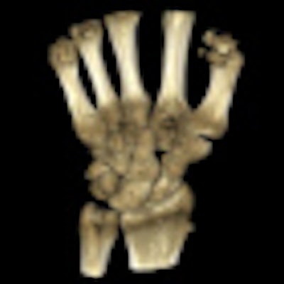 2010 11 10 14 36 22 397 Verity Bone Image Thumb