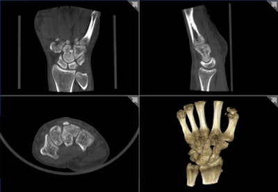 2010 11 10 14 36 30 461 Verity Bone Image 450