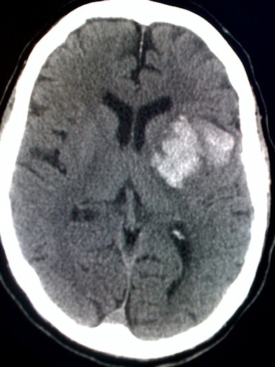 2010 11 15 14 21 26 923 Avinsider Image 394