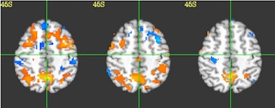 2010 11 17 16 33 33 625 P120 450