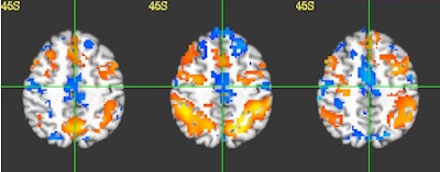 2010 11 17 16 33 35 172 112 450