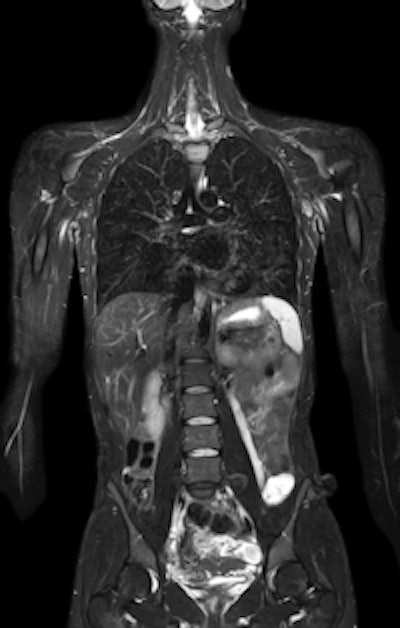 2010 11 28 18 13 02 424 2010 11 29 Ingenia