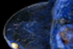 2010 11 28 18 16 56 428 Philips Pet Mr Breast Image Thumb