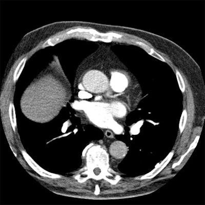 2010 11 29 10 35 32 887 Barraza bottom Image