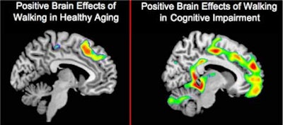 2010 11 29 10 59 57 526 Raji Alz Mri Figure2 450