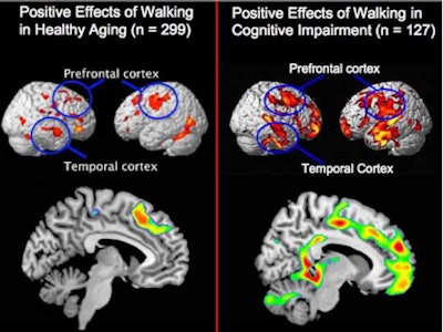 2010 11 29 10 59 59 875 Raji Alz Mri Figure1 450